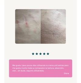 Crema anti estrías natural | Elasticidad y reparación