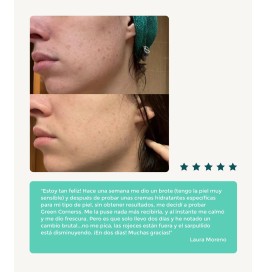 Crema facial piel atópica y sensible | Hidratación